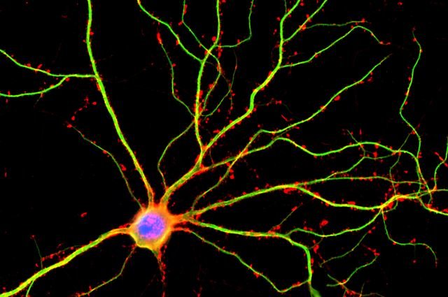 Gli scienziati dell’UCLA hanno scopertto che I dentriti (mostrat in verde) non sono asssolutamente semplici trasportatori I corrente elettrica tra neuroni. Fonte: Shelley Halpain/UC San Diego